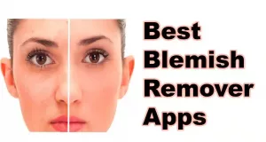 Best Blemish Remover Apps